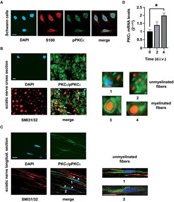 Protein kinase C epsilon activation regulates proliferation, migration, and epithelial to mesenchymal-like transition in rat Schwann cells